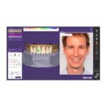 LOGICIEL DENTAIRE EXOCADE 3.2